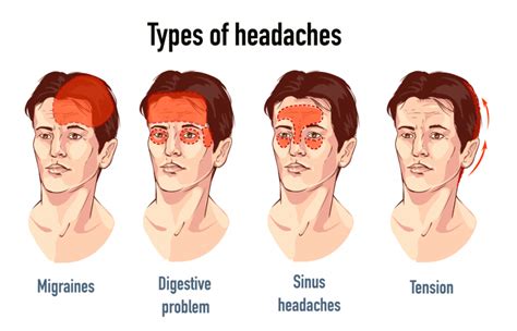 What Does Headache Location Mean
