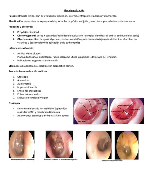 Audiometria Tonal Limiar Via Aérea óssea