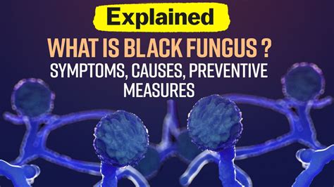 What Is Black Fungus Latest Symptoms Causes Preventive Measures