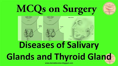 Surgery Mcqs Thyroid Disorders And Salivary Glands Disorders Youtube