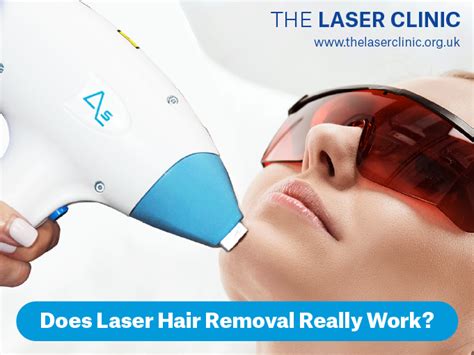 Does Laser Hair Removal Really Work Laser Clinic
