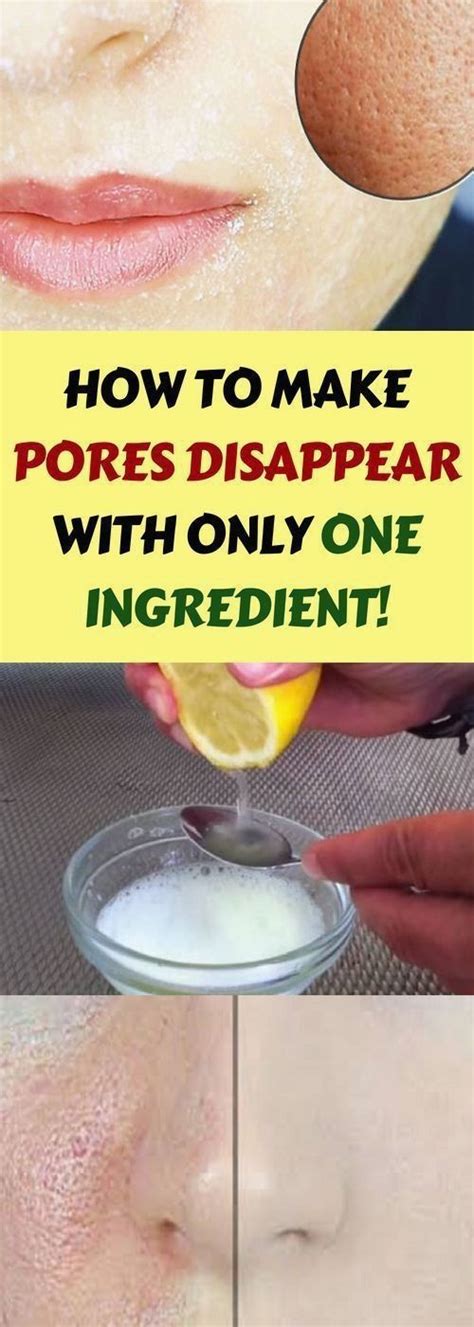 How To Make Pores Disappear With Only 1 Ingredient Health Diy