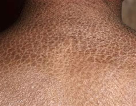 Scaly Skin On Legs Dorothee Padraig South West Skin Health Care
