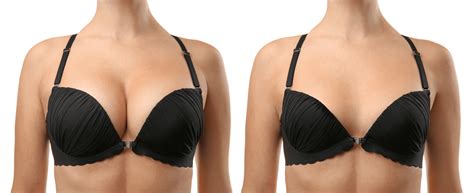 The Many Benefits Of A Breast Reduction Orlando Fl The Institute Of