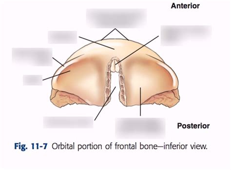 Orbital Portion Of Frontal Bone Inferior View Diagram Quizlet