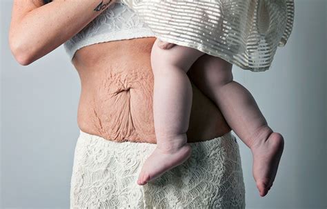 Post Pregnancy Photo Series Shows How Mothers Bodies Look After Giving Birth Beautiful Bodies