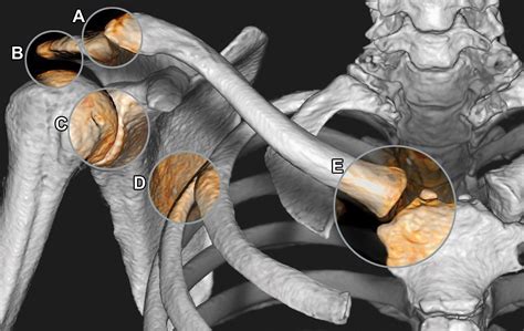 Anatomy Of The Sternoclavicular And Acromioclavicular Joints Osmosis