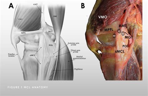 Medial Collateral Ligament Mcl Tear Chicago Il Jorge Chahla Md