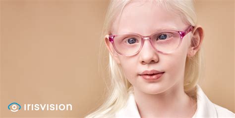 Can Ocular Albinism Be Corrected With Prescription Glasses Irisvision