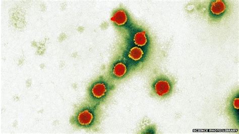 Bird Flu Egyptian Woman Dies Of H5n1 Virus Bbc News
