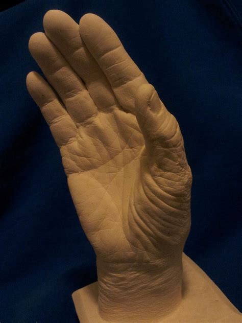 Plaster Alginate Casts Of My Hand Diy 5 Steps With Pictures