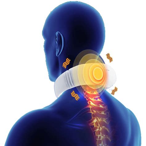 Neck Pain Download Free Png Png All Png All