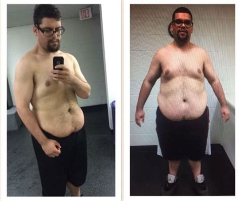 M 45 5 11 [160lbs 260lbs 420lbs] 6months Before And After Ds Weight Loss Surgery