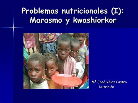 Ppt Problemas Nutricionales I Marasmo Y Kwashiorkor Powerpoint