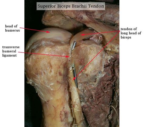 The long head of the biceps is the longer of its two tendons. Long head of biceps brachii muscle | Cadaver Pictures ...