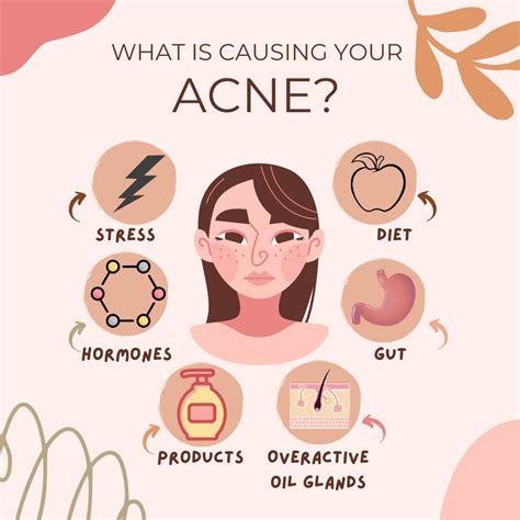 What Is Causing Your Acne
