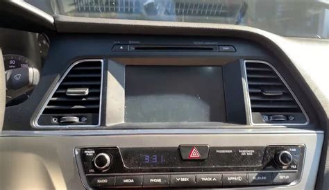 Hyundai Sonata Radio Display Not Working Causes And Fixes You Should Know