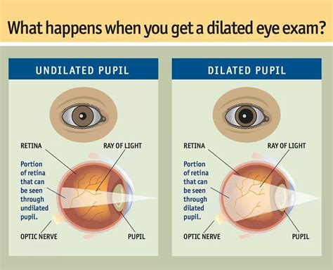 Undilated Vs Dilated Pupil Dilated Pupils Eye Exam Eye Facts