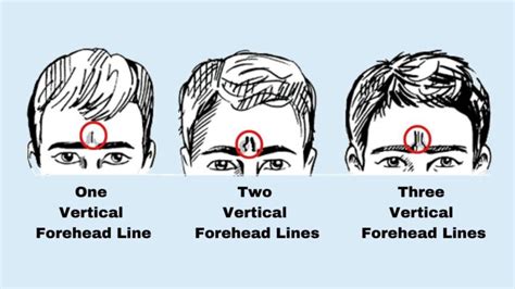 Personality Test Your Forehead Lines Reveal Your Hidden Personality