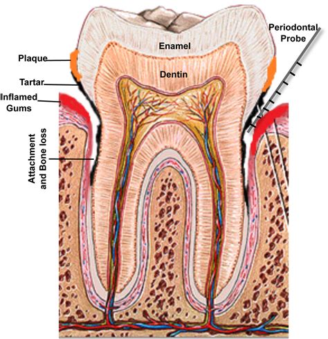 A Schematic Of The Human Tooth Illustrating The Process Of Periodontal