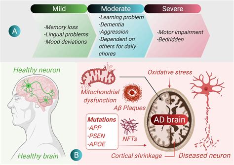Nanomaterials in Alzheimer’s disease treatment: a comprehensive review