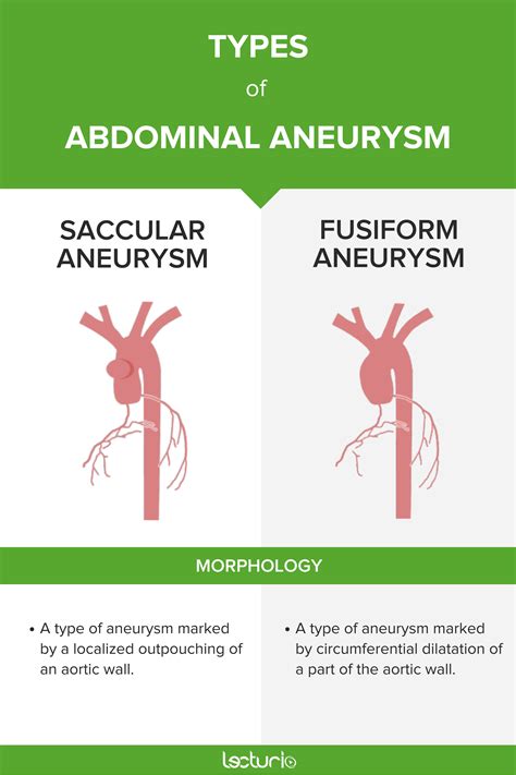 Aortic Aneurysm Aortic Aneurysm Abdominal Aortic Aneurysm Aortic