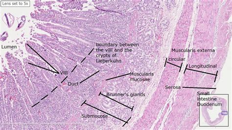 There are 3 different types of muscle: note the smooth muscle bands at the muscularis regions ...