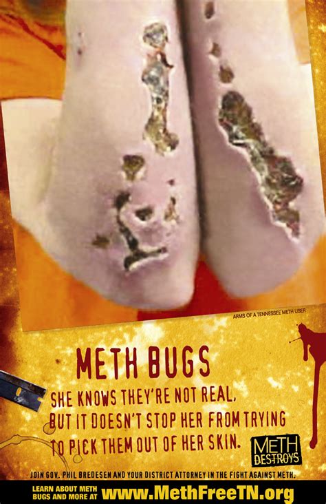 Meth Photos Before And After Poster