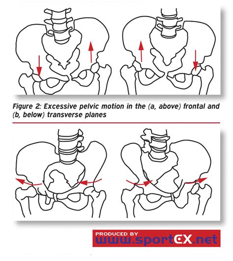 Excessive Pelvic Motion In The A Above Frontal And B Below