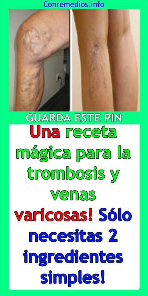 En un individuo vivo la sangre puede coagularse pero esto es fuera del aparato circulatorio por ejemplo. Una receta mágica para la trombosis y venas varicosas ...