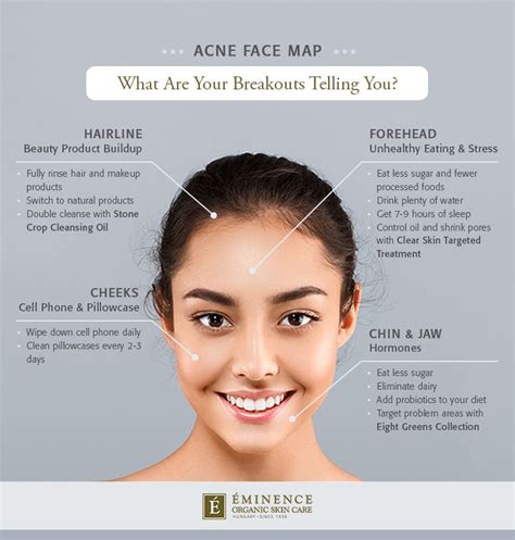 Acne Face Map What Are Your Breakouts Telling You Face Mapping Acne
