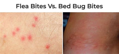 What Do Bed Bug Bites Look Like Pictured Public Health