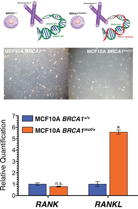 Brca1 Haploinsufficiency Cell Autonomously Activates Rankl Expression