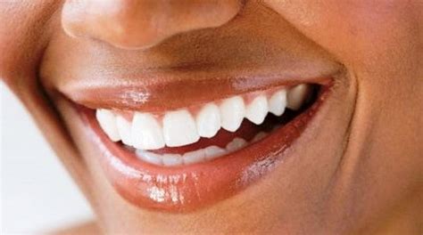 Belfiore Aesthetics Natural Tips To Maintain Healthy White Teeth