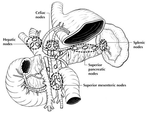 Regional Lymph Nodes Of The Pancreas Anterior View With Pancreatic