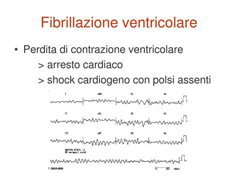 Definizione, ultime notizie, immagini e video dal dizionario medico del corriere della. PPT - SEMEIOTICA DEI POLSI ARTERIOSI Il polso e il ...