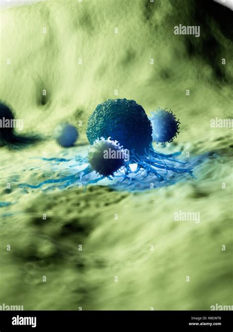 Illustration Of A Cancer Cell Being Attacked By White Blood Cells Stock