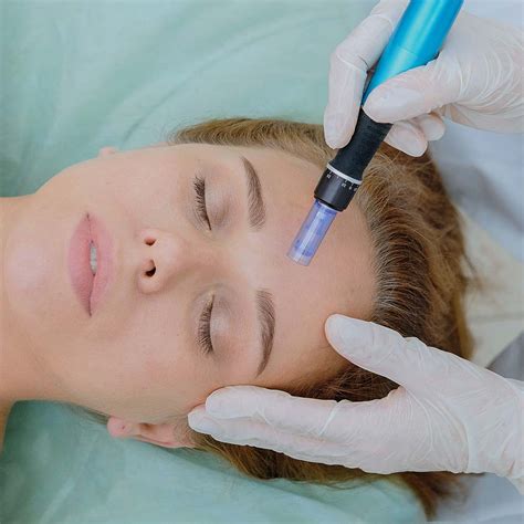 Mesotherapy Heswall Laser Clinic