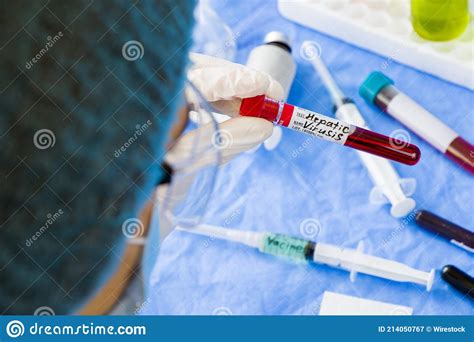 Doctor Holding A Hepatic Blood Test Tube Sample In A Laboratory Stock Image Image Of Care