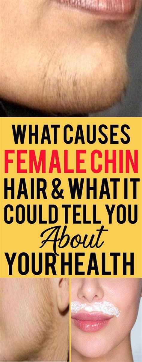 Chin Female Hair Health What Causes Female Chin Hair And What It