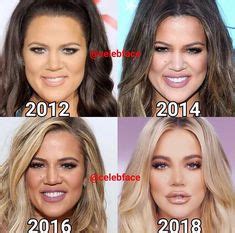 Khloe kardashian oozed glamour during the latest episode of kuwtk! Pin by Elizabeth Gilardo on CELEBRITY PLASTIC SURGERY in ...