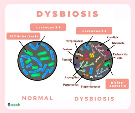 Dysbiosis Microbial Imbalance Symptoms Causes And Natural Treatment