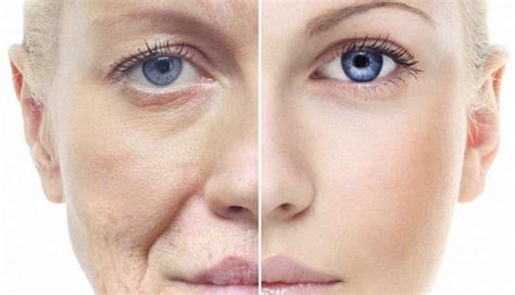 7 Dos And Donts For Dehydrated Skin Idaho Skin Institute Dermatology
