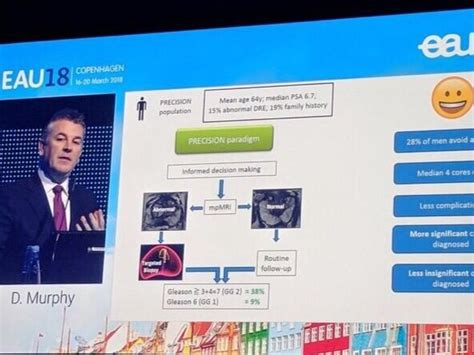 Mri Scanning And Prostate Biopsy — Professor Declan Murphy