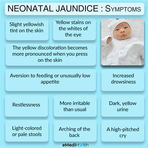 Jaundice In Newborns Treatment And Care At Home