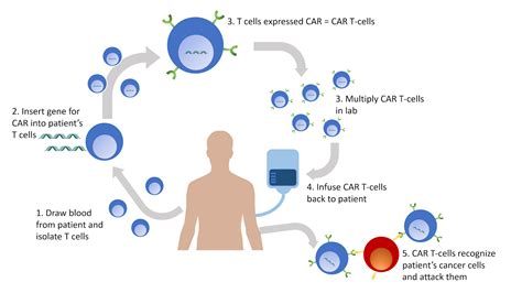 Nc Dna Day Car T Cell Therapy