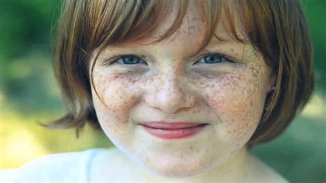 In most cases, freckles are harmless. Why Do We Get Freckles and Birthmarks? - YouTube