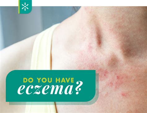 Do You Know What Type Of Eczema You Have Paradise Valley Dermatology