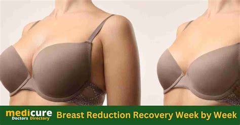 Breast Reduction Recovery Week By Week Medicure