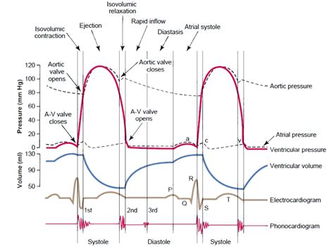 A Quick Guide To ECG IVLine